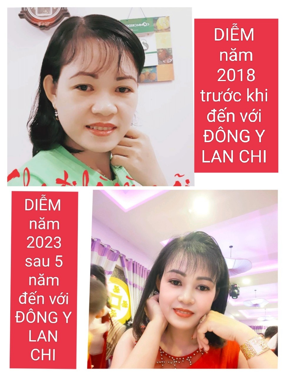 Cuộc lột xác ngoạn mục của cô giáo mầm non mắc phải căn bệnh chết người Viêm lộ tuyến cổ tử cung giai đoạn tiền ung thư. Trở thành Giám Đốc Kinh Doanh Công ty Đông Y Lan Chi và là Boss Team Diễm Trâu Điên Bình Dương TT31